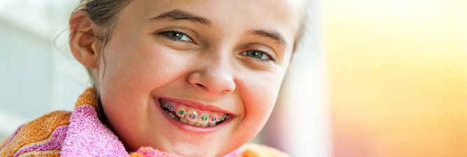 Traditional Braces
